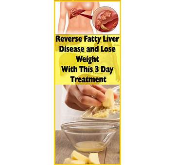 Fatty Liver Lose Weight